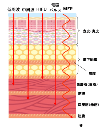 筋膜リペア ・ほぐし そして引き締め と1度に全ての効果を発揮します。